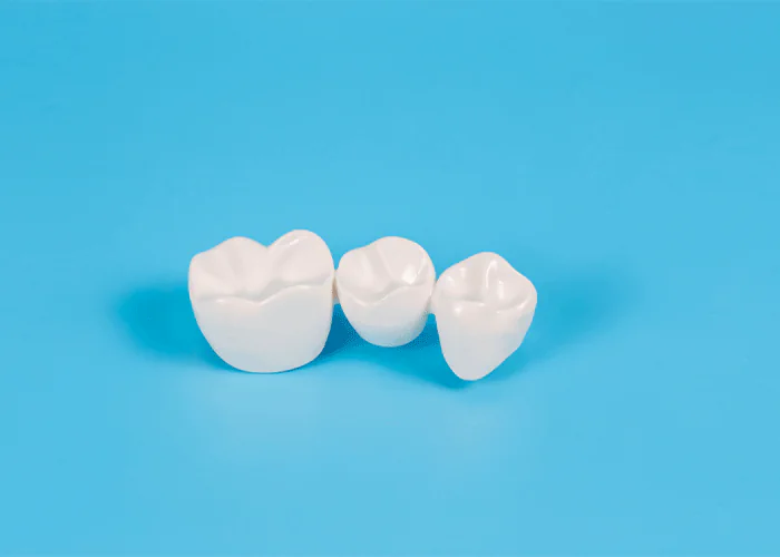 Tooth Colored Crowns in Victor, New York at Victor Smiles